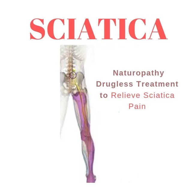 Sciatica