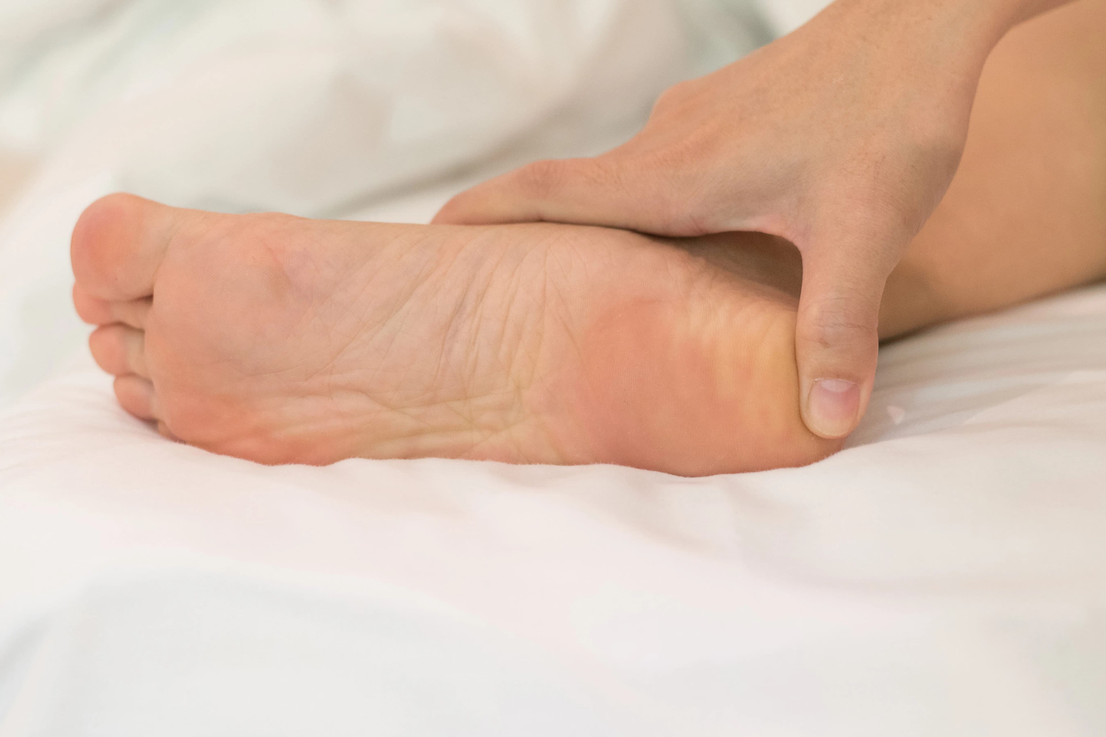 Calcaneal Spur Pain