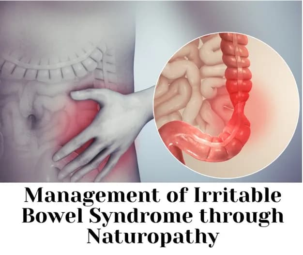 IBS (Irritable Bowel Syndrome)