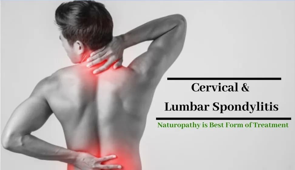 Spondylitis-Cervical &
Lumbar