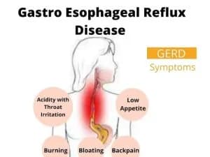 Gastro Esophageal Reflux Disease (GERD)